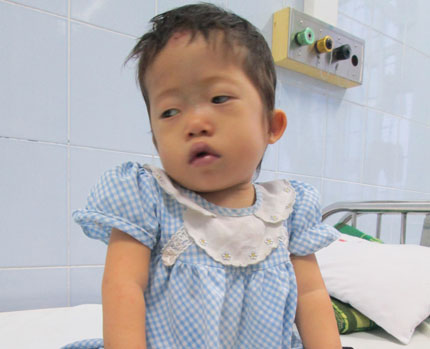 Bé 3 tuổi từng bị bỏ rơi tím tái không thể phẫu thuật được 1