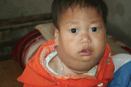 Ám ảnh đôi mắt buồn của bé Phạm Nhật Quang 2