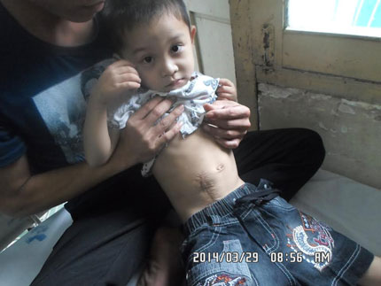 Xót xa cậu bé dân tộc Thái 5 tuổi chờ chết trên giường bệnh 1