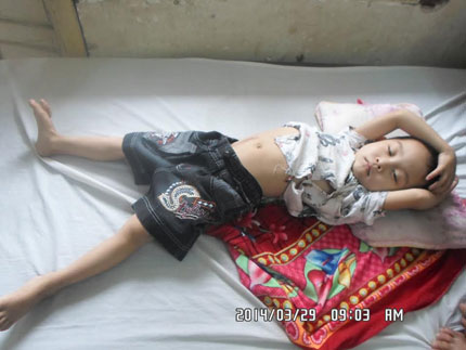 Xót xa cậu bé dân tộc Thái 5 tuổi chờ chết trên giường bệnh 3