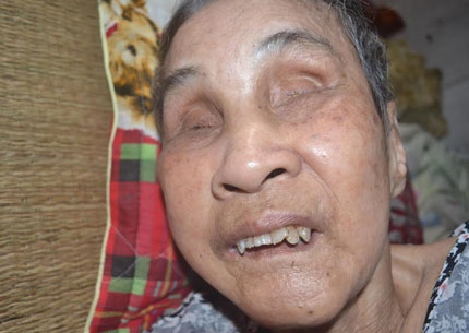 Cuộc sống cùng cực của cụ bà 82 tuổi mù hai mắt, nằm liệt giường 4