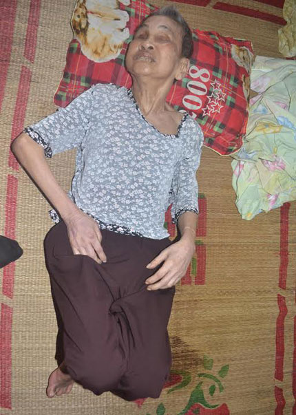 Cuộc sống cùng cực của cụ bà 82 tuổi mù hai mắt, nằm liệt giường 5