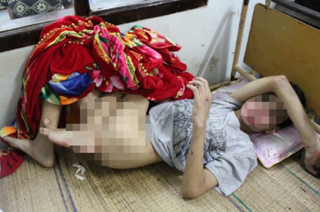 Cháu Nguyễn Văn Tú (SN2002) bị hành hạ dã man trong thời gian bị bắt cóc