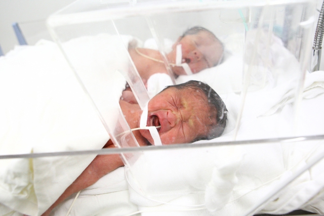 Khi vừa chào đời, các bé phải thở bằng máy hỗ trợ hô hấp nhưng nay 4 bé đã có thể tự thở với sự hỗ trợ ôxy.
