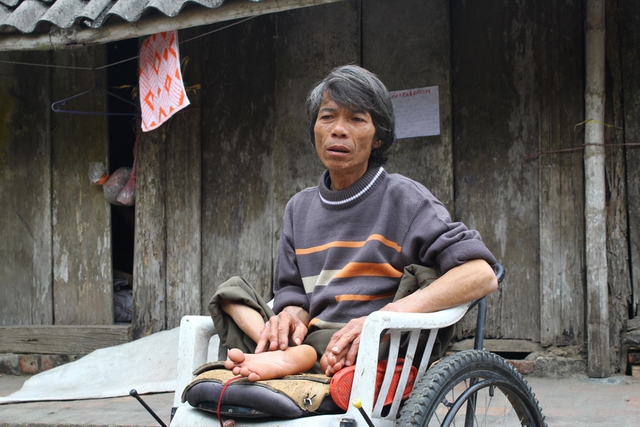 Ông Nguyễn Trung Sổng (SN 1958), bị khuyết tật vận động nặng. Cuộc sống của ông Sổng nhờ vào sự chăm sóc của người dì là vợ hai của bố và hàng xóm, họ hàng chăm sóc.