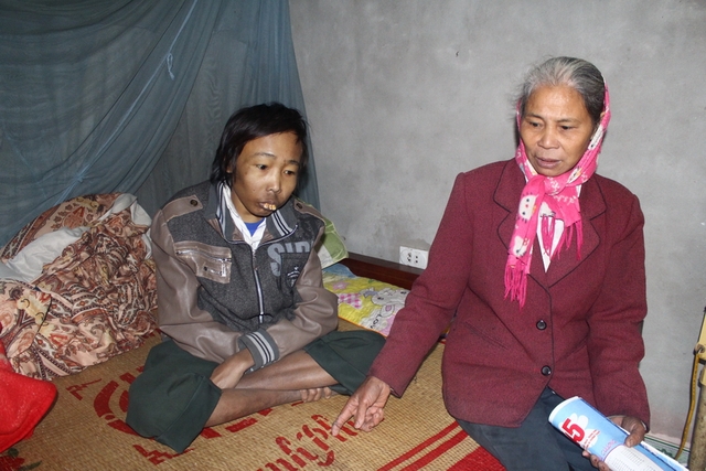 Để có tiền cho con trai chữa bệnh, mẹ anh Doan, bà Ngô Thị Kến (60 tuổi) phải lên Hà Nội làm nghề nhặt phế thải. Cũng như ông Sổng, mỗi tháng theo chế độ, anh Doan được 270 nghìn, nhưng năm qua, anh chỉ nhận được 180 nghìn.