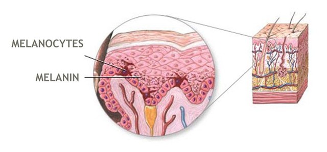 Những sắc tố Melamin được kích thích sinh sản khi bị UVA và UVB trong tia cực tím chiếu vào, hậu quả là da sẽ xuất hiện những vết ta hay gọi là thâm đen, nám hay tàn nhang, do đó sử dụng kem trắng da chống nắng là thực sự cần thiết và quan trọng nếu như bạn muốn sỡ hữu làn da trắng mịn màng.