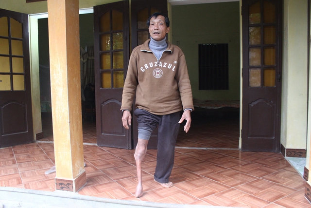 Ông Ngô Doãn Xoa (SN 1961), bị tàn tật, liệt một chân từ nhỏ. Theo quyết định của UBND TP Phủ Lý, mỗi tháng ông Xoa được nhận 270 nghìn trợ cấp nhưng cũng bị cán bộ xã xà xẻo mất 90 nghìn.