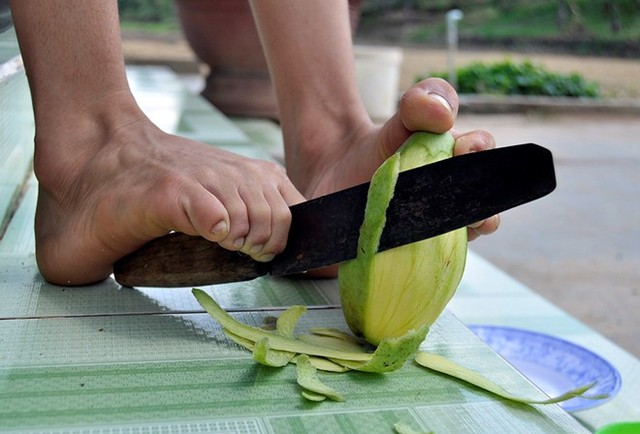 Cậu bé không tay đoạt huy chương bơi lội