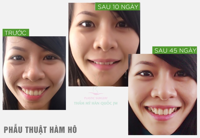 E:\Du Lieu Tu May Cu\chau\Hinh anh\hinh in album\ham ho\04.jpg