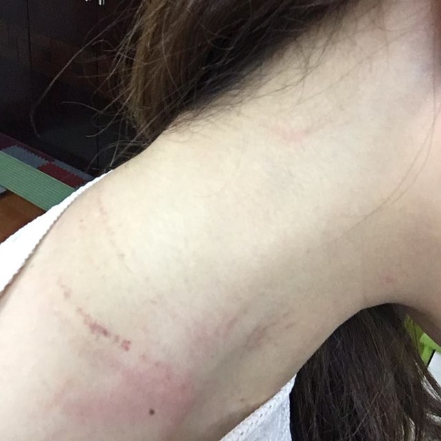 Nhân viên mặt đất của Vietnam Airlines bị hành khách túm áo, đánh vào cổ và đầu. Ảnh: N.V.M.