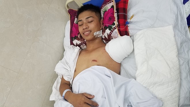 D&ugrave; mất c&aacute;nh tay tr&aacute;i sau tai nạn, Huy vẫn lạc quan v&agrave; y&ecirc;u đời. Ảnh: Ho&agrave;ng Như.