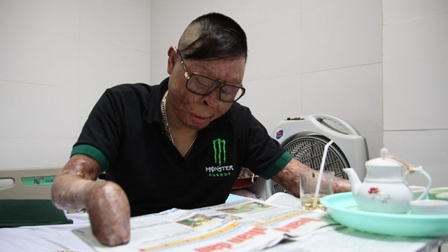 Thượng úy Đinh Văn Dương đọc báo trong lúc nằm viện tại Viện bỏng quốc gia Lê Hữu Trác