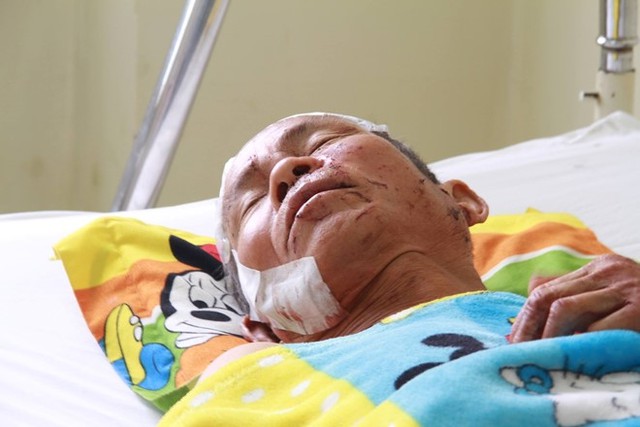 Nạn nh&acirc;n Nguyễn Kim Sinh đang cấp cứu tại Bệnh viện Đa khoa tỉnh Kh&aacute;nh H&ograve;a. Ảnh: An B&igrave;nh.
