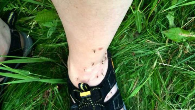 Chắc hẳn bạn đã từng hỏi sao những con muỗi đáng ghét cứ chọn chân mình để đốt?