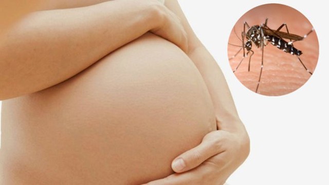 
Không phải thai phụ nào mắc virus Zika cũng sinh con bị dị tật.
