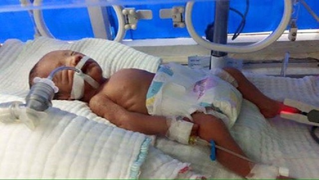 
Con trai anh Hoàng Văn Sự sinh thiếu tháng đang nằm trong lồng kính tại bệnh viện Cuba Đồng Hới. Ảnh: Nguyễn Bảo Ngọc
