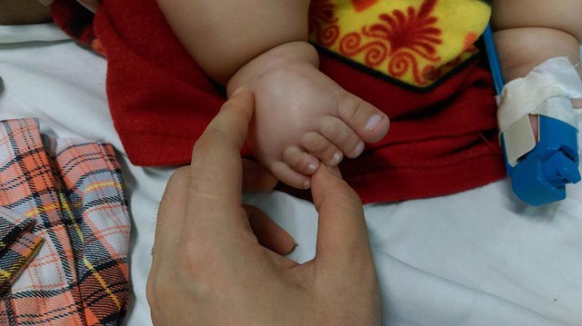 
Ngón chân của bé Nguyễn Văn Nhật bị phù nề. Ảnh: Ngọc Thi
