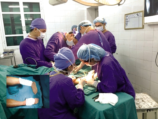 Các bác sĩ phẫu thuật, cứu hai bàn chân cho bệnh nhân. Hai bàn chân bị đứt rời trước khi được phẫu thuật (ảnh nhỏ). Ảnh Bệnh viện Việt Đức cung cấp