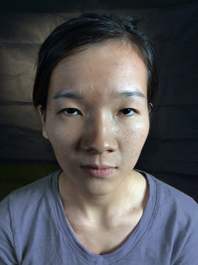 Lương Thị Hà, sinh viên năm 4 ĐH Y khoa Vinh kể về nỗi khổ mắt lươn trên confession của trường gây bão mạng.