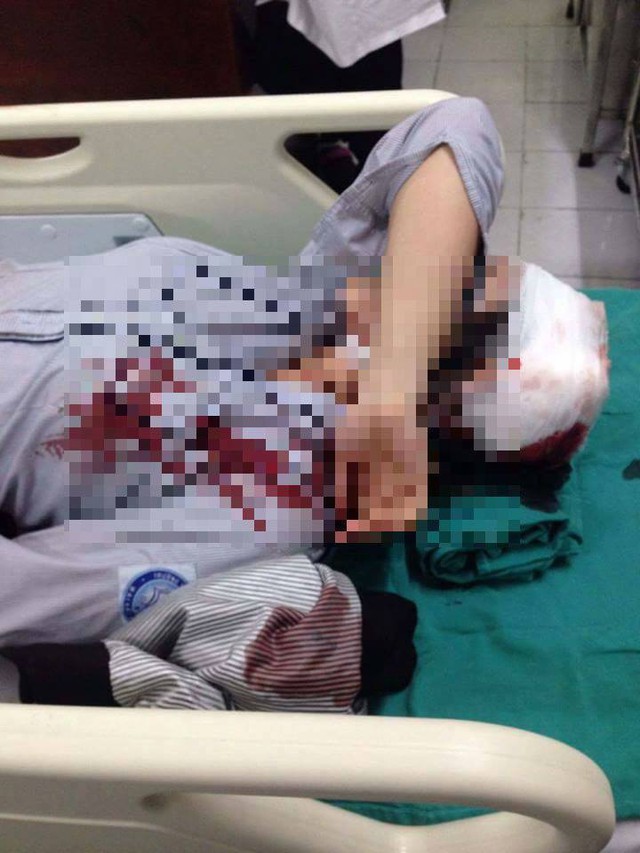 Nữ sinh bị bạn đánh hiện đang được cấp cứu tại Bệnh viện Bạch Mai.