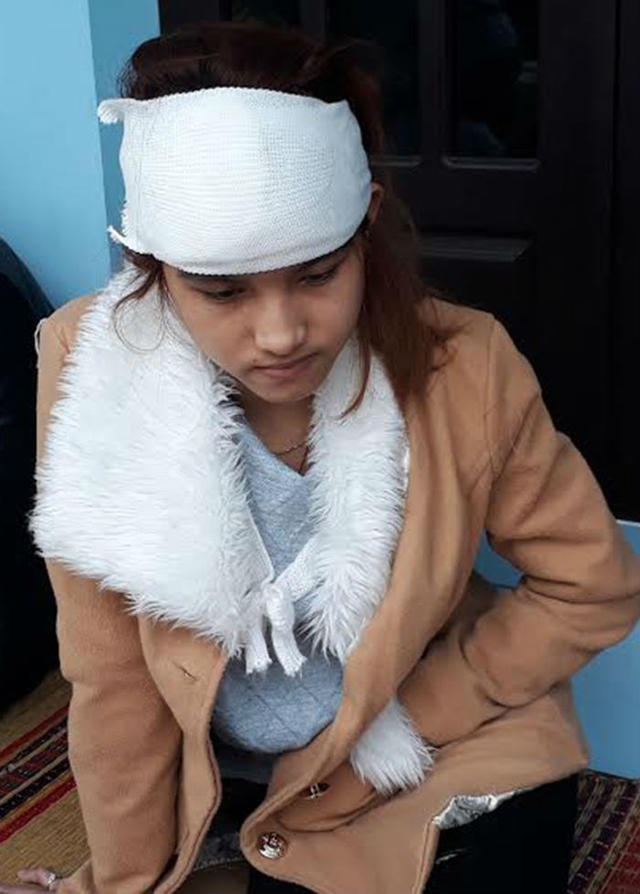 Chị Huỳnh Thị Thanh Xuyến vẫn chưa hết b&agrave;ng ho&agrave;ng sau vụ chị g&aacute;i m&igrave;nh bị s&aacute;t hại.