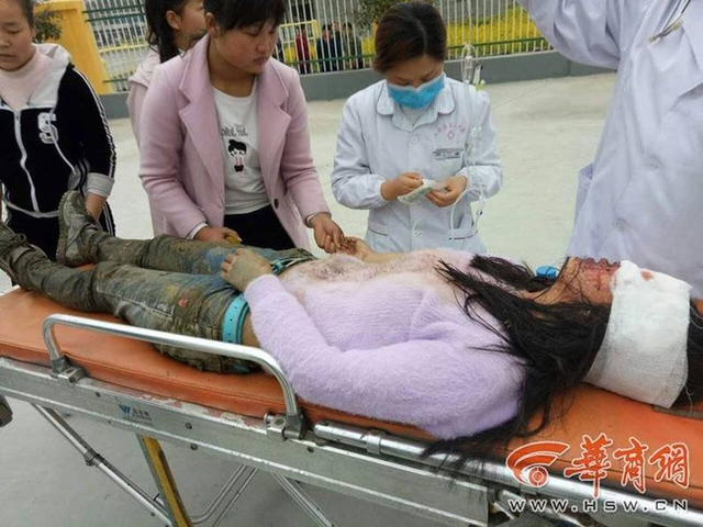 Tiểu Tĩnh khi vừa được giải cứu và đưa vào viện