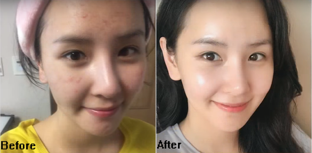 Làn da của cô nàng này đã được cải thiện rất nhiều khi áp dụng phương pháp rửa mặt với toner