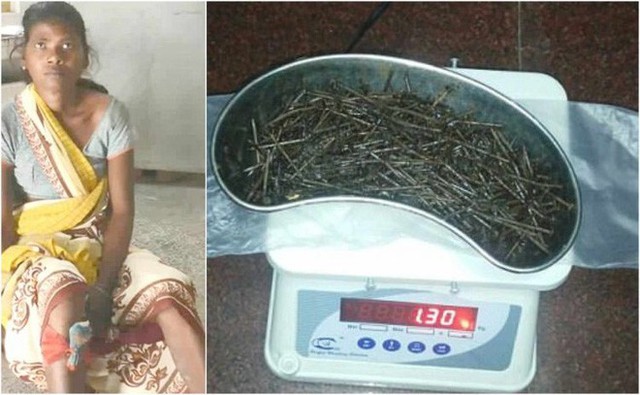 C&ocirc; Anusuiya Devi v&agrave; những vật thể kim loại kh&ocirc;ng r&otilde; l&yacute; do v&igrave; sao loại xuất hiện ở b&ecirc;n trong ch&acirc;n của m&igrave;nh.