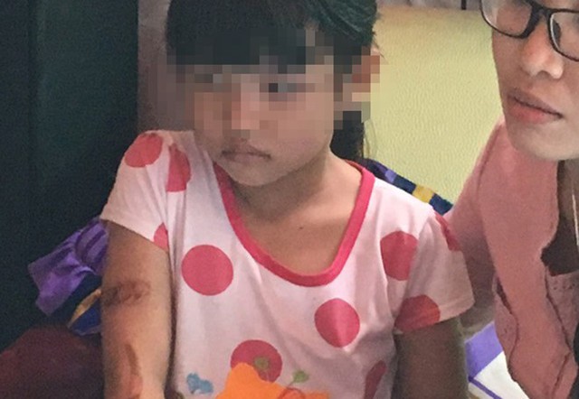 B&eacute; g&aacute;i tỏ ra sợ sệt, thường xuy&ecirc;n nh&igrave;n mẹ khi kể chuyện với đo&agrave;n kiểm tra. Ảnh: Tri thức trực tuyến