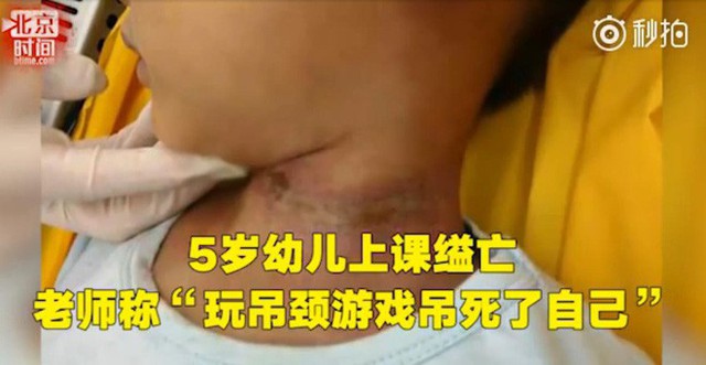 B&eacute; Long Long được ph&aacute;t hiện đ&atilde; tử vong trong lớp học với vết lằn tr&ecirc;n cổ.