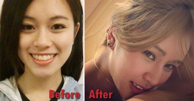 Berry Ng trước khi phẫu thuật (bên trái) và gương mặt sau khi phẫu thuật thẩm mỹ 30 lần (bên phải)