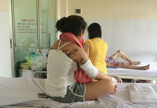 Một người bệnh bị tạt axit từng chữa trị ở BV Chợ Rẫy