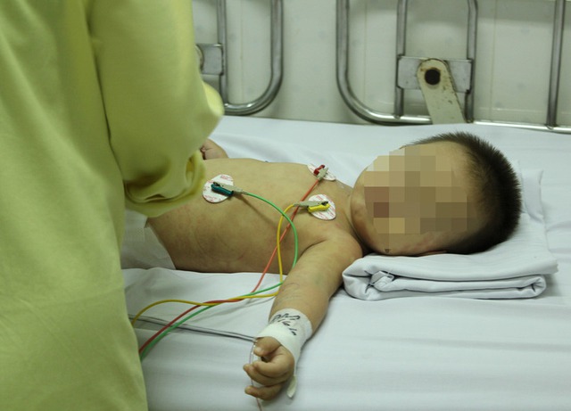 Ch&aacute;u b&eacute; trong vụ &aacute;n cha n&eacute;m chết con ruột qua đời khi chưa tr&ograve;n 22 th&aacute;ng tuổi. Ảnh minh họa