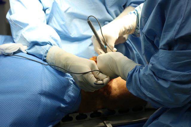 Sau khớp gối chân phải, bệnh nhân còn phải quay lại Việt Nam để phẫu thuật khớp gối còn lại