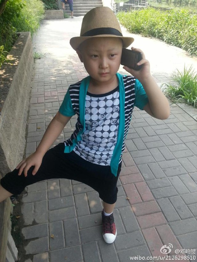 Ảnh khi bé Minh Hạ đã phải xạ trị vì ung thư. Ảnh: Weibo.