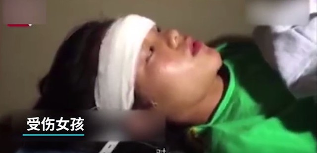Nữ nghệ sĩ trẻ bị thương vùng đầu, gãy xương đùi sau tai nạn. Giới chức Hồ Nam cho biết chương trình biểu diễn xiếc không được cấp phép.