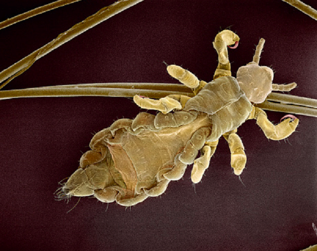 Là 1 loài côn trùng ký sinh cư trú ở trên da và tóc của đầu người - chí hay chấy sinh sống bằng cách hút máu vật chủ người cũng như thú vật.
