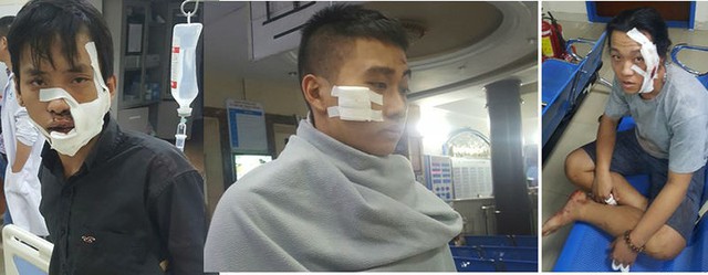 Ba trong năm thanh niên bị thương trong cuộc hỗn chiến.