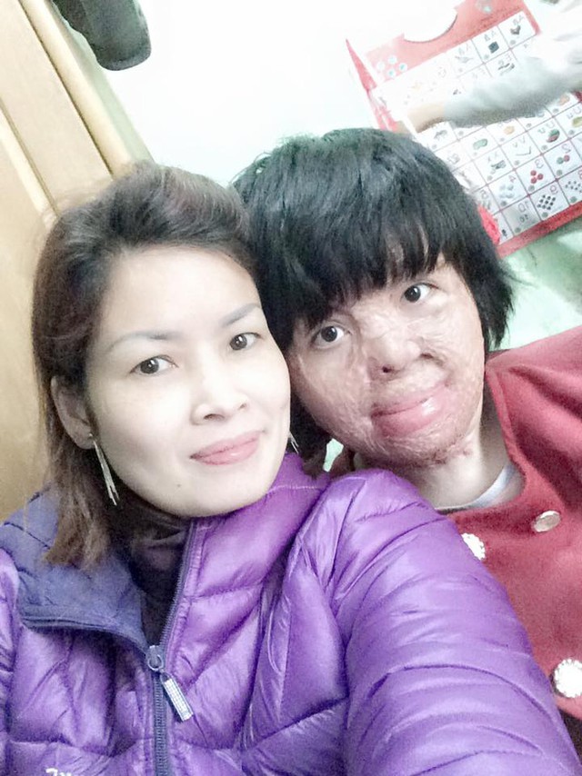 C&ocirc; g&aacute;i nhỏ vẫn cố gắng từng giờ từng ph&uacute;t để sống tốt hơn, lạc quan hơn, h&ograve;a nhập với mọi người hơn