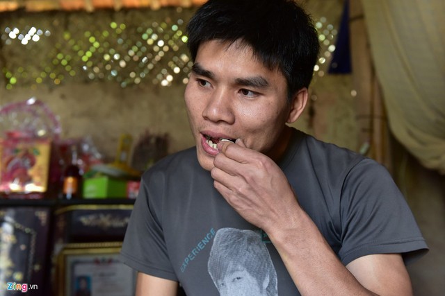 
Anh Hải, th&ocirc;n Thống Nhất, cũng l&agrave; một trong những người ăn đất cuối c&ugrave;ng ở Vĩnh Ph&uacute;c. Anh Hải cho biết m&igrave;nh đ&atilde; ăn đất từ nhỏ. Khi thưởng thức, anh thấy đất r&ograve;n, b&ugrave;i v&agrave; dễ g&acirc;y nghiện.
