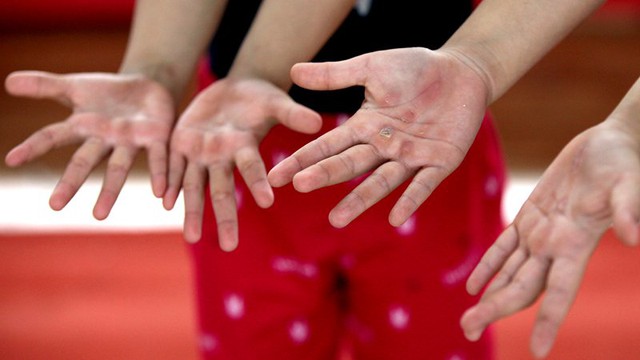 Những bàn tay đầy nốt chai sần của các bé gái - vận động viên thể dục dụng cụ Hà Nội.