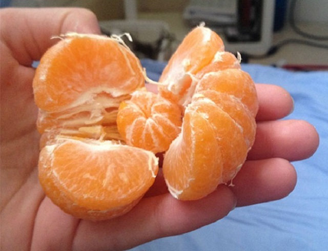 Cảm giác sướng rơn khi vừa bóc quả cam ra lại trúng thưởng thêm một quả nữa.