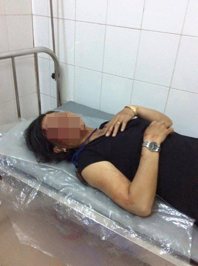 
B&agrave; H. phải nhập viện.
