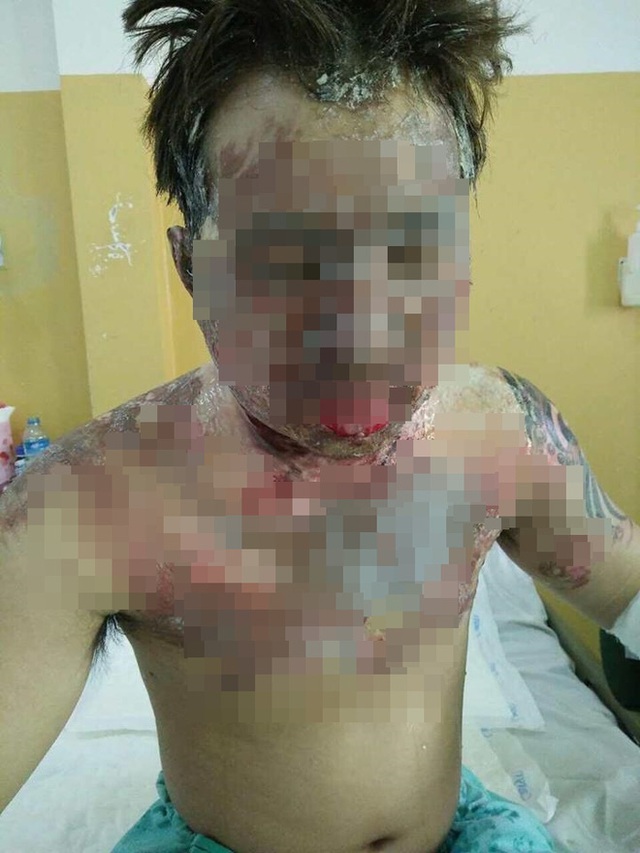 To&agrave;n bộ gương mặt người chồng biến dạng.