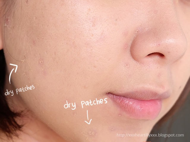 Kem nền không ăn tiệp vào da khi makeup là một dấu hiệu của da thiếu nước.