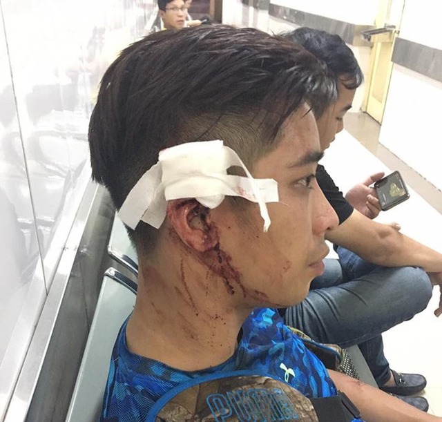 
H&igrave;nh ảnh anh D. l&uacute;c bị v&agrave;o viện
