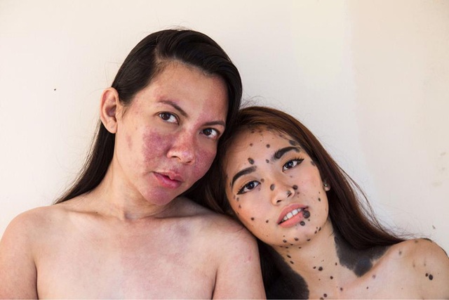 
Dự &aacute;n True Complexion do c&ocirc; s&aacute;ng lập đ&atilde; truyền cảm hứng cho rất nhiều người gặp phải những khiếm khuyết bị x&atilde; hội coi l&agrave; kh&oacute; chấp nhận.
