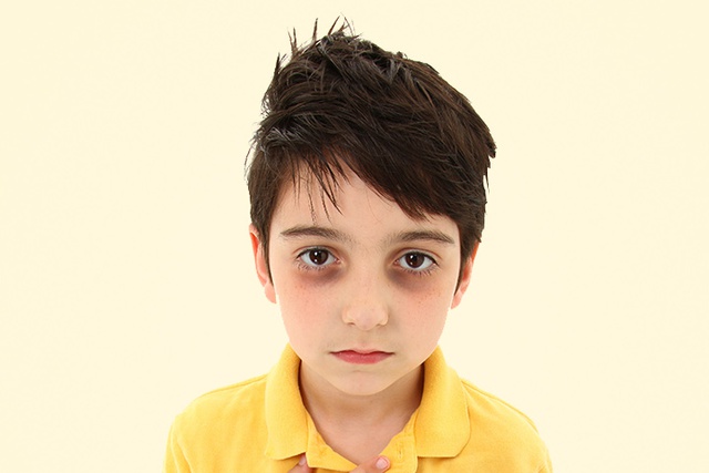 
Theo các chuyên gia, phụ huynh không nên chủ quan khi thấy mắt trẻ xuất hiện quầng thâm kéo dài. Ảnh minh họa
