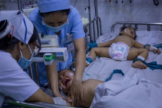 
Từ tháng 9/2018, nhiều trẻ mắc tay chân miệng nặng vào điều trị tại các bệnh viện nhi ở TP HCM. Ảnh: Thành Nguyễn.
